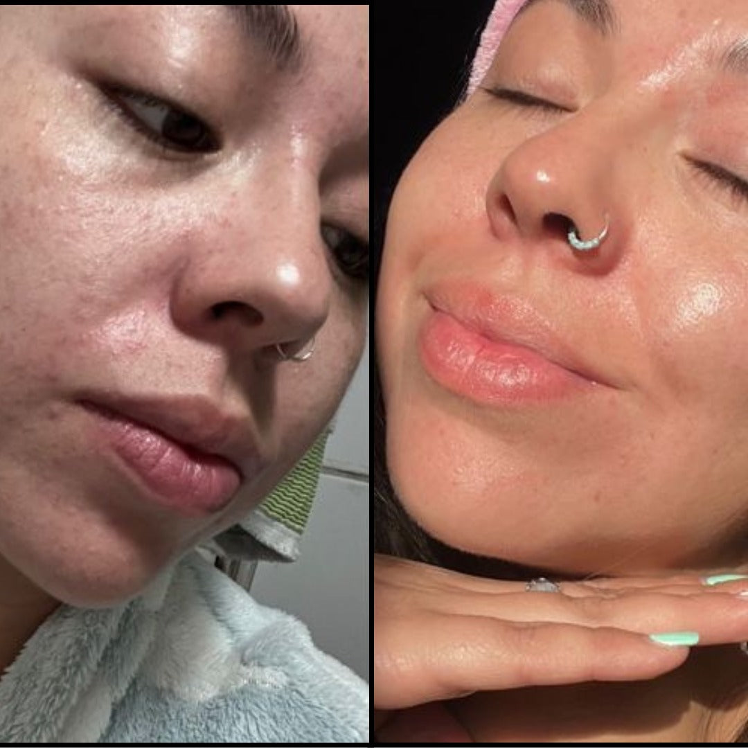 Renova+ – Bienestar real, belleza natural