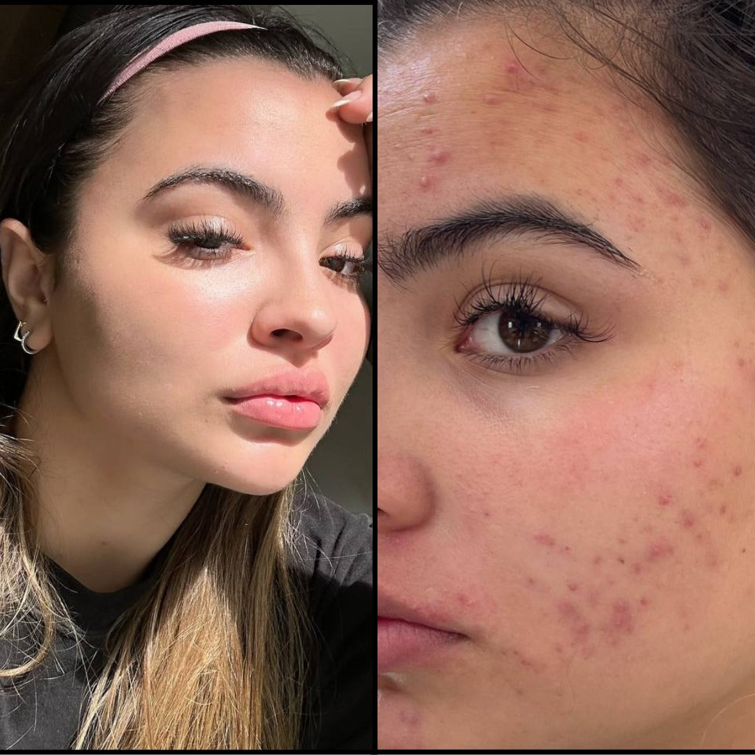 Renova+ – Bienestar real, belleza natural